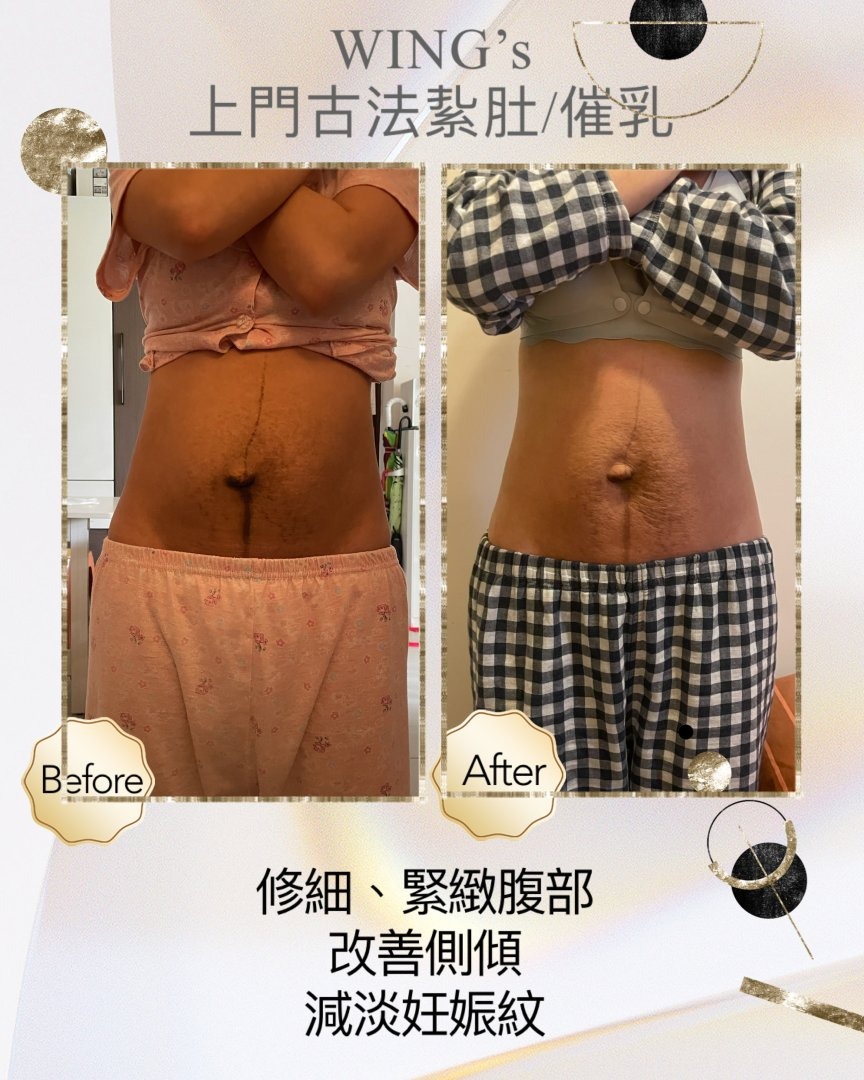 Wing's 護理相片 0