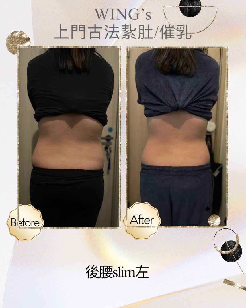 Wing's 護理相片 11