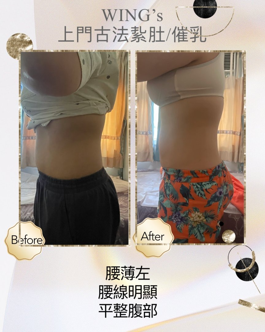 Wing's 護理相片 13