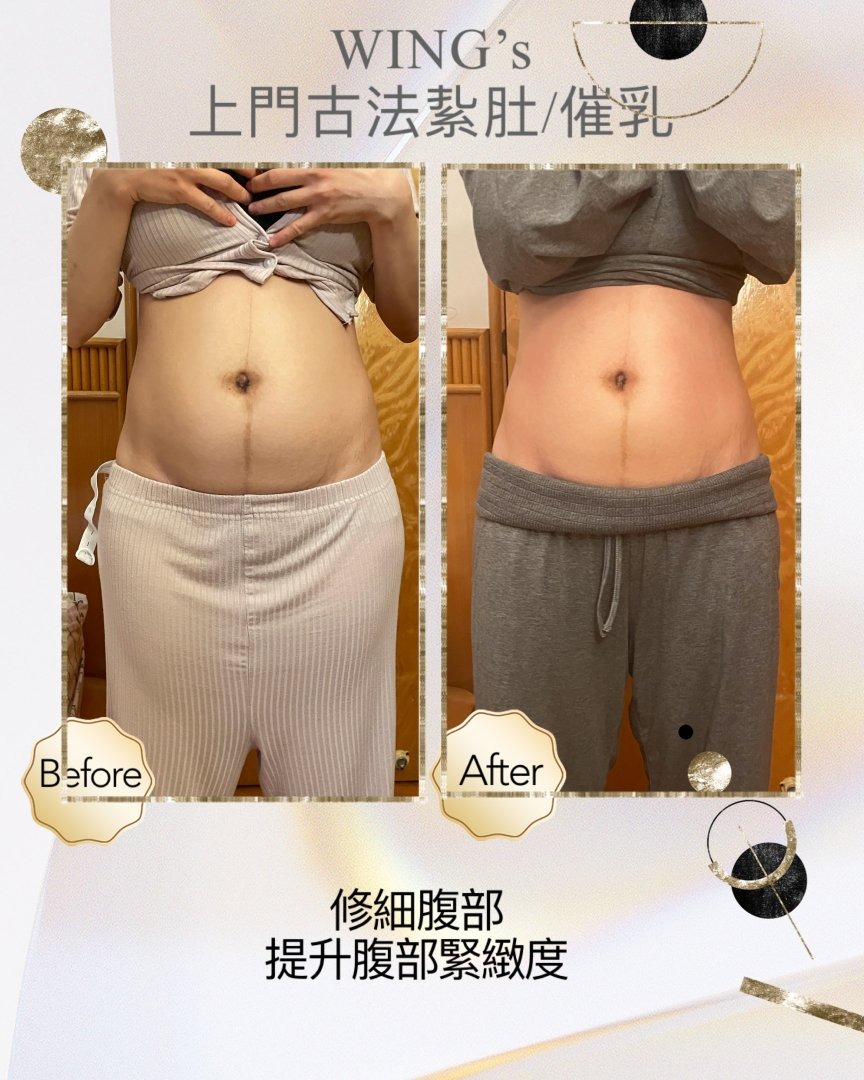 Wing's 護理相片 15