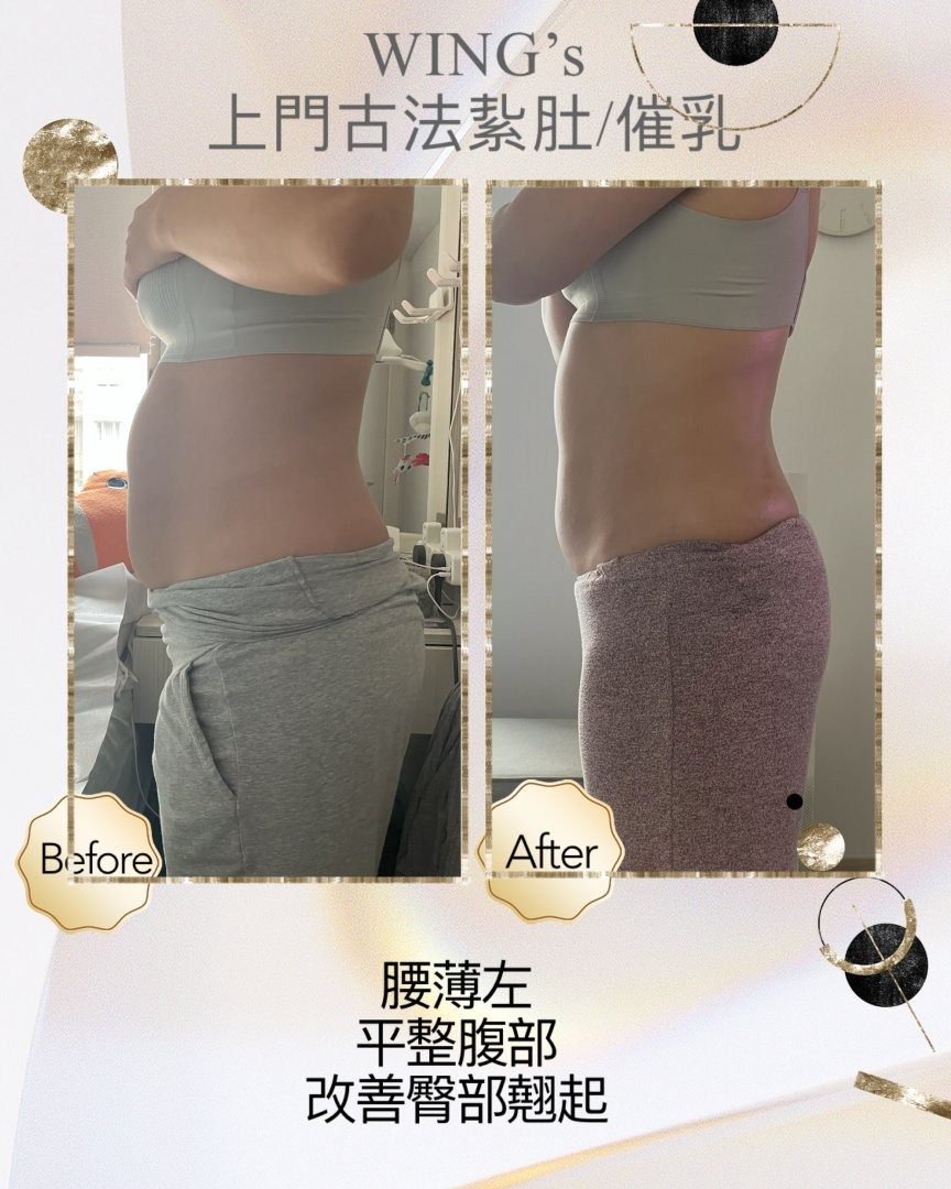 Wing's 護理相片 19