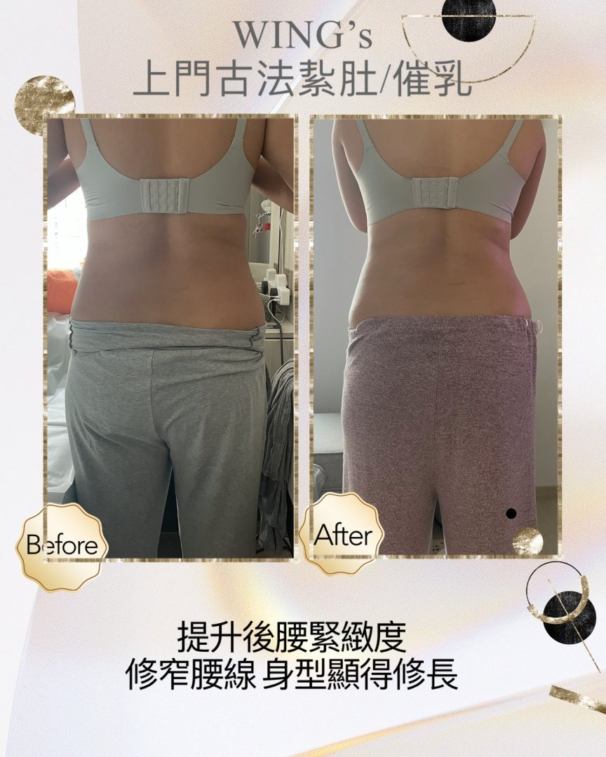 Wing's 護理相片 20