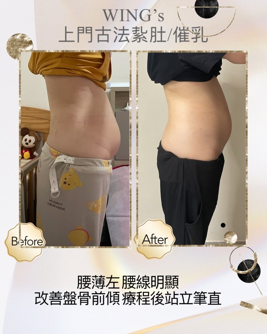 Wing's 護理相片 22