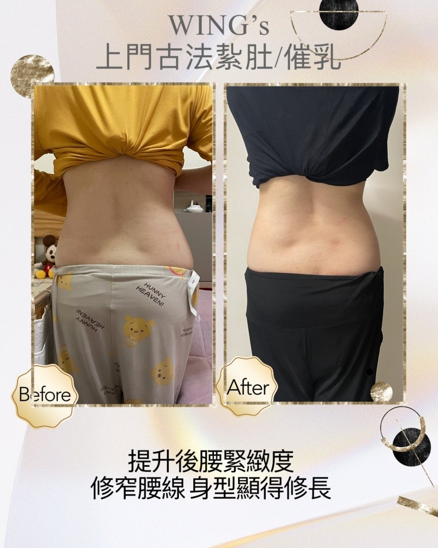 Wing's 護理相片 23