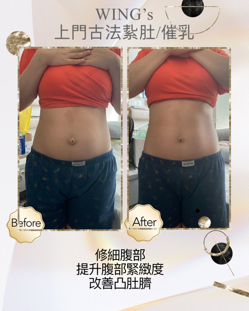 Wing's 護理相片 24