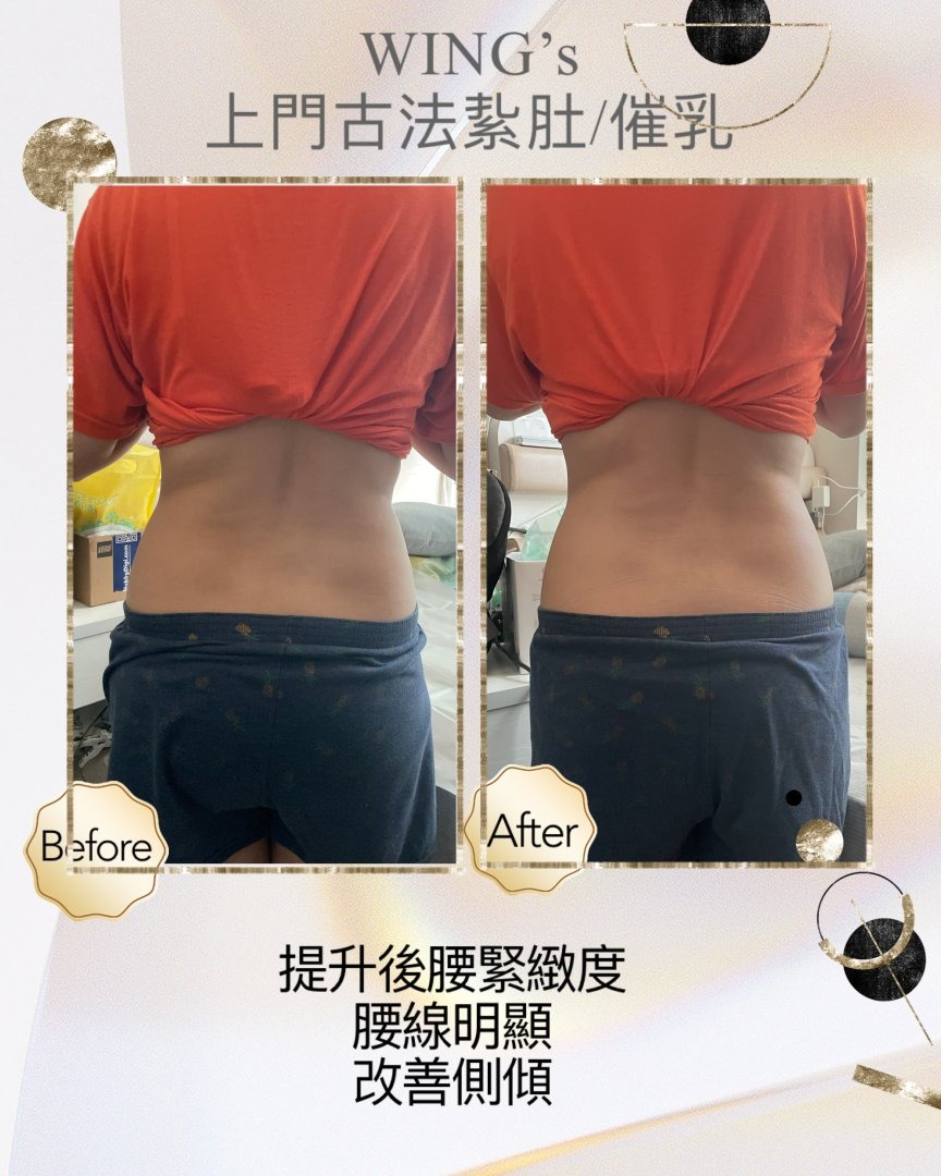 Wing's 護理相片 26