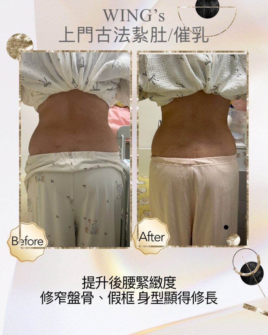 Wing's 護理相片 29