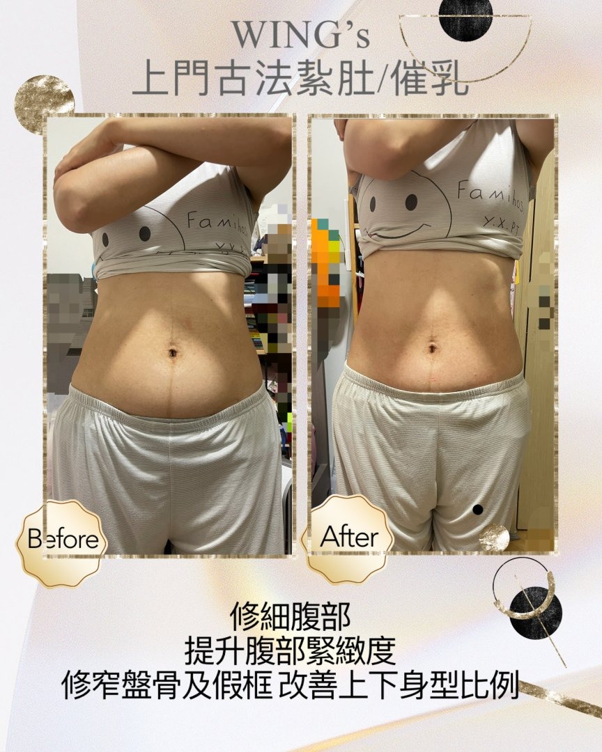 Wing's 護理相片 30