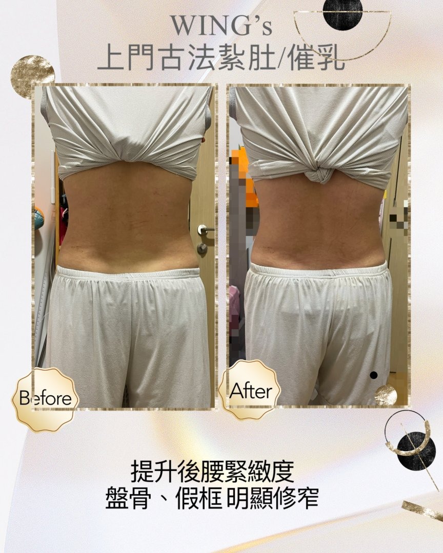 Wing's 護理相片 32