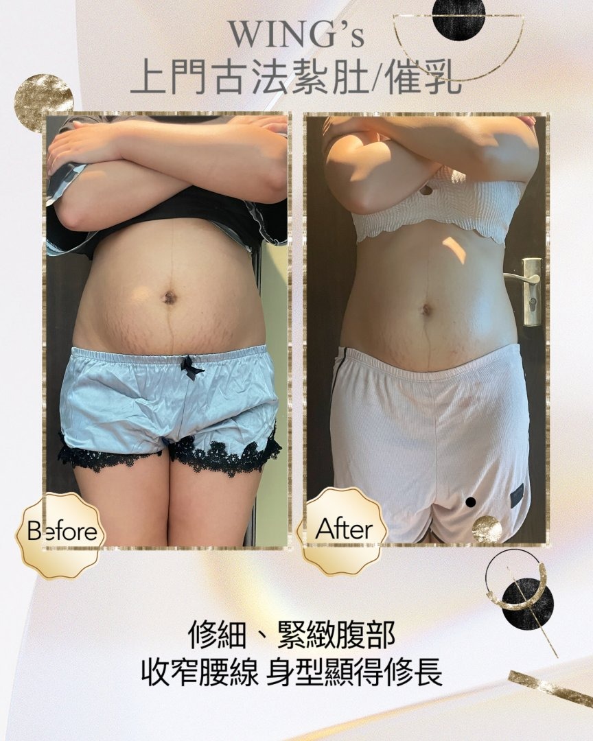 Wing's 護理相片 33