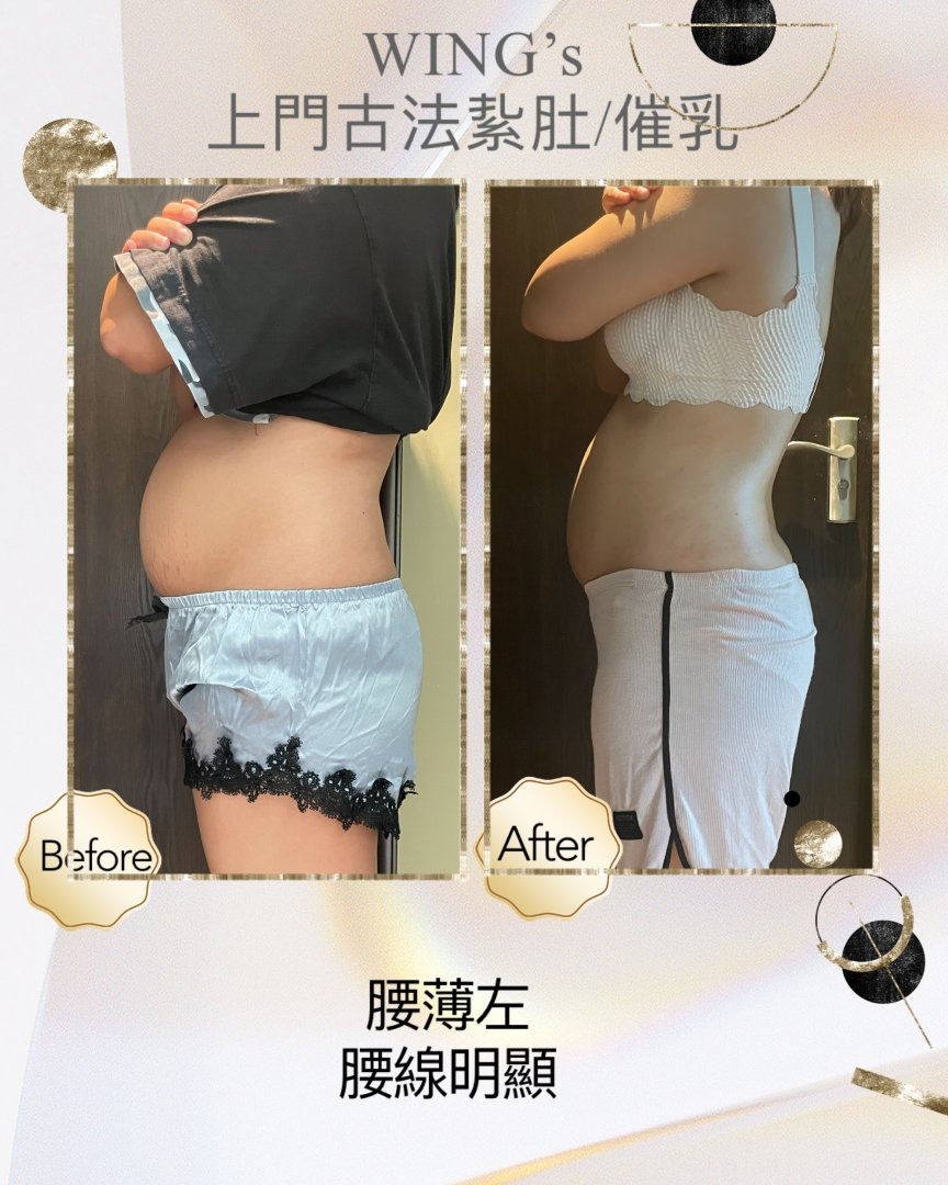 Wing's 護理相片 34