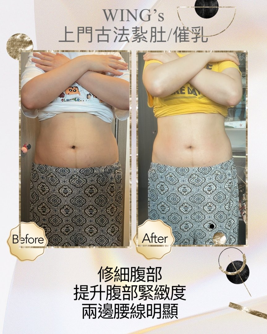 Wing's 護理相片 36