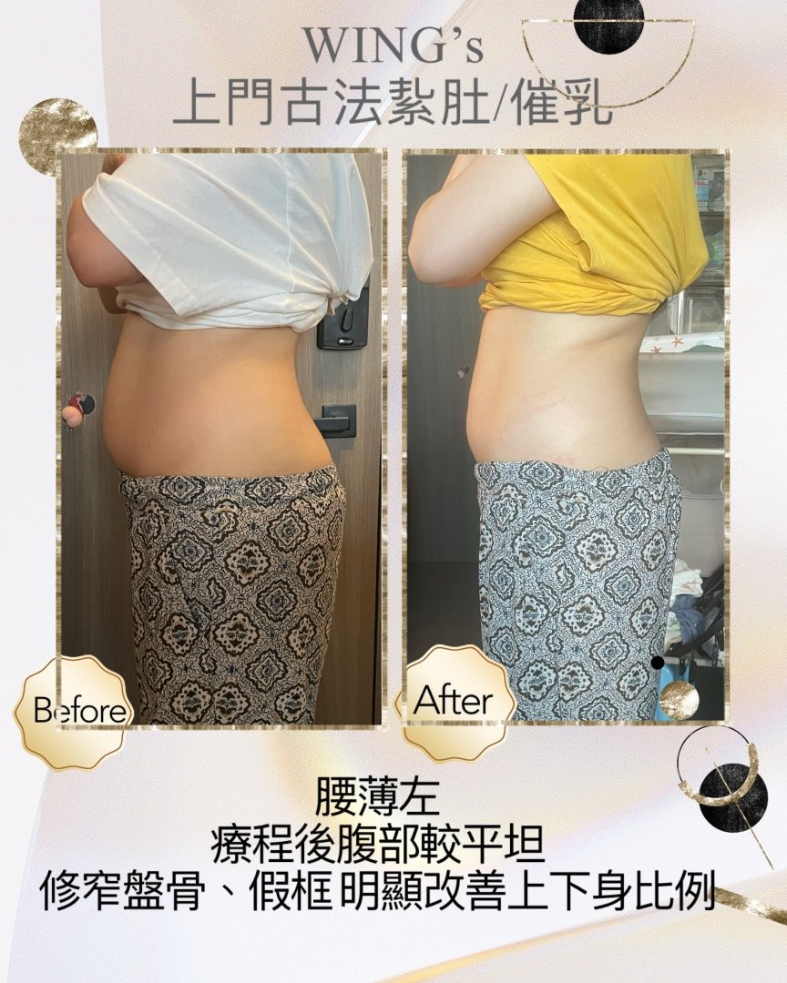 Wing's 護理相片 37