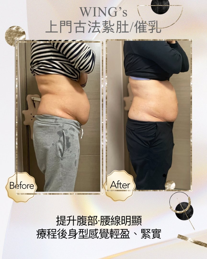 Wing's 護理相片 40