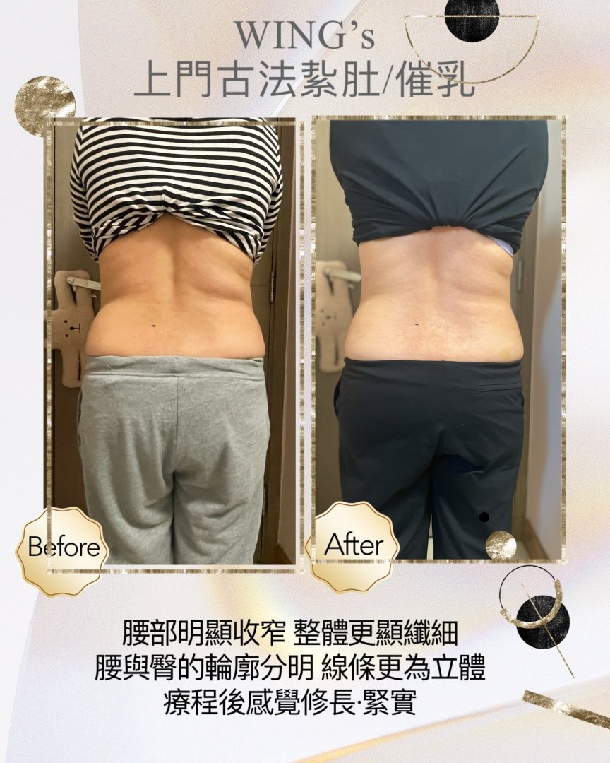 Wing's 護理相片 41