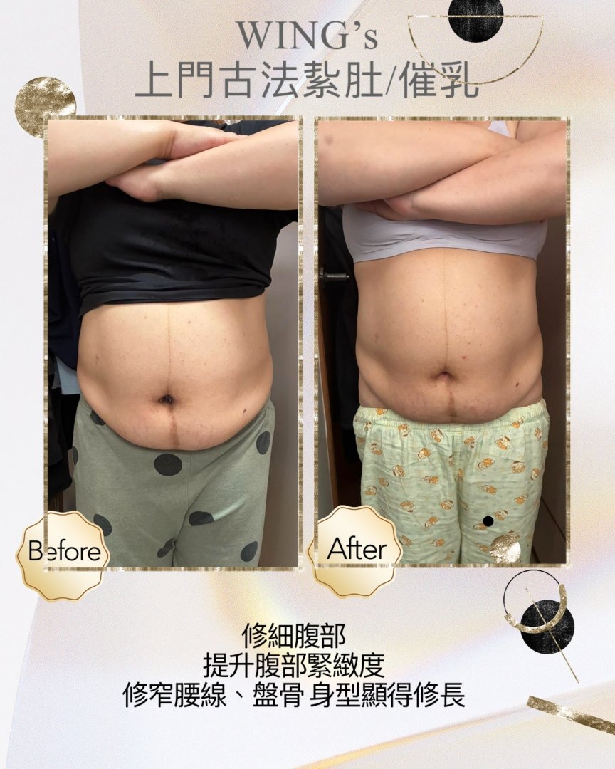 Wing's 護理相片 42