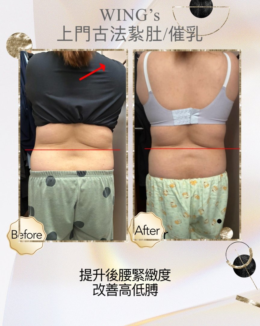 Wing's 護理相片 44